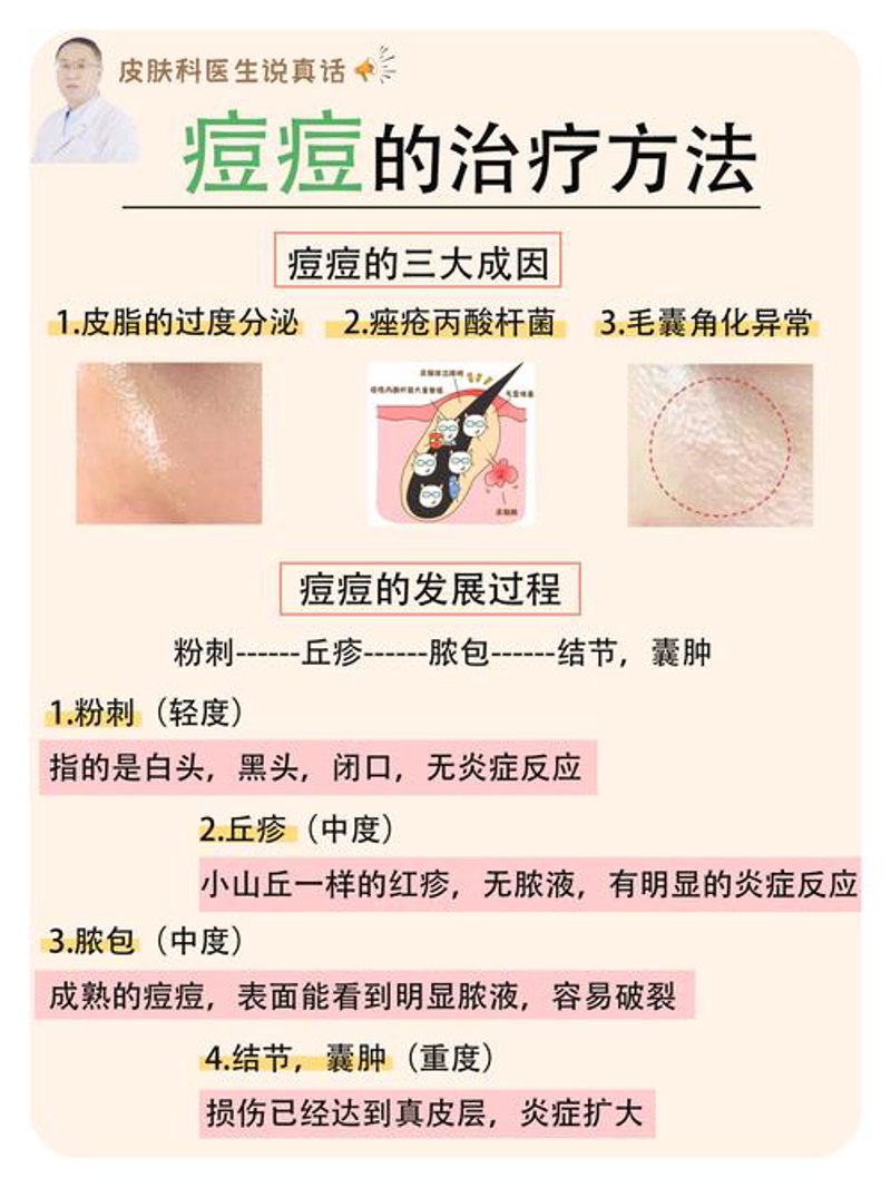 太原祛痘妙招揭秘，告别青春烦恼